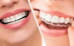 Orthodontie adulte Casablanca gouttières invisibles